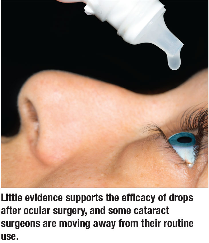 rethinking-routine-use-of-steroid-drops-after-surgery